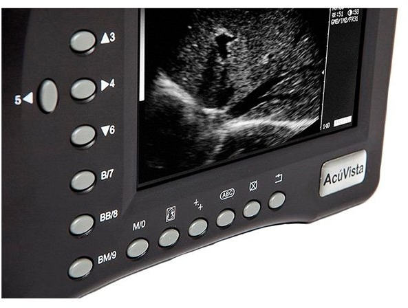 Портативный УЗИ сканер AcuVista RS880b